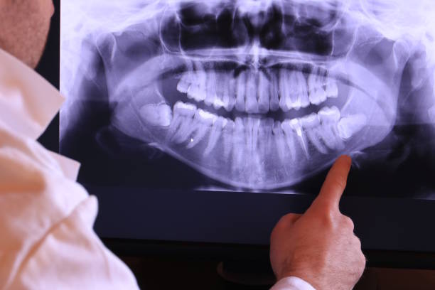 Best Emergency Broken Tooth Repair in Silver Firs, WA