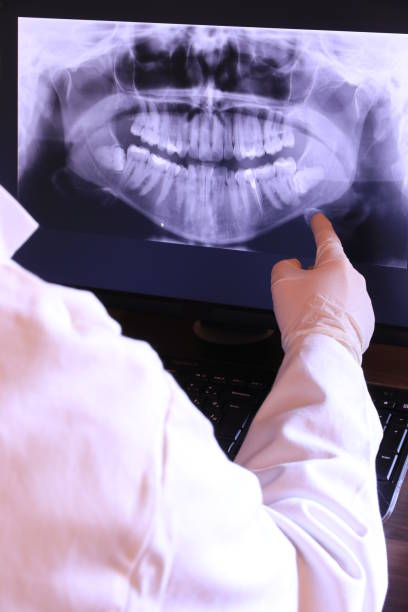 Best Emergency Treatment for Toothache in Silver Firs, WA